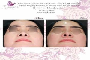gallery img